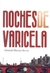 NOCHES DE VARICELA