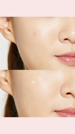 Acne Pimple Master Patch - Original Care en internet
