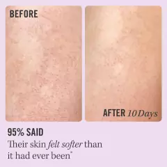 First Aid Beauty - Mini KP Bump Eraser Body Scrub with 10% AHA 28.3g - comprar online