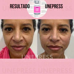 LIFTING FACIAL 10ml na internet