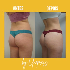 BUMBUM INCRÍVEL 10ml na internet