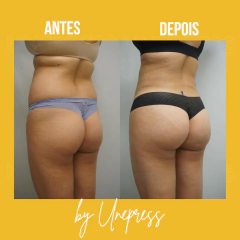 BUMBUM INCRÍVEL 10ml - Unepress