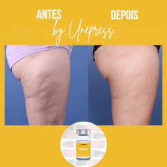 CELULITE 10ml - Unepress