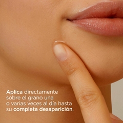 ISDIN ACNIBEN ON THE SPOT GEL SECANTE CORRECTOR DE GRANOS FACIALES X 15ML en internet