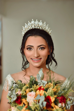 Coroa Alta Em Zircônias Ana Regina Dourada
