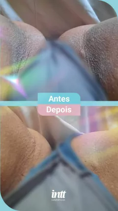 Kit Clareador Intimo Com 3 Produtos na internet