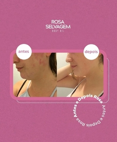 Rosa Selvagem Clareador de manchas, estrias e foliculite 100ml na internet