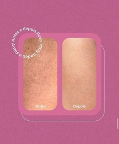 Rosa Selvagem Clareador de manchas, estrias e foliculite 100ml - Eleve Você Oficial - Emagrecedores & Cuidados Pessoais | Innovate