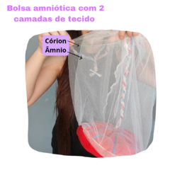 Bebê RN + Placenta