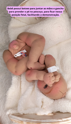Imagem do Bebê RN + Placenta