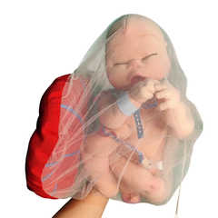 Imagem do Bebê RN + Placenta + Útero