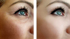 Contorno De Ojos Reparador Antiage Tensor Lifting 40 Grs. Belgrano CABA Envios a Todo el Pais - comprar online
