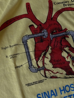 1980 Coronary Artery Bypass - G na internet
