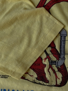 1980 Coronary Artery Bypass - G - Andino Vintage & Upcycle