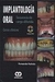 IMPLANTOLOGIA ORAL