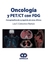 ONCOLOGIA Y PET/CT CON FDG