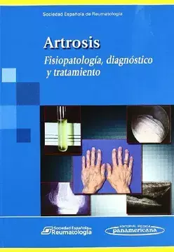 ARTROSIS - FISIOPATOLOGIA, DIAGNOSTICO Y TRATAMIENTO - SOCIEDAD ESPAÑOLA DE REUMATOLOGIA