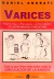 VARICES - PAUTAS PARA LA PREVENCION Y EL TRATAMIENTO DE LAS ENFERMEDADES CIRCULATORIAS - ONORATI
