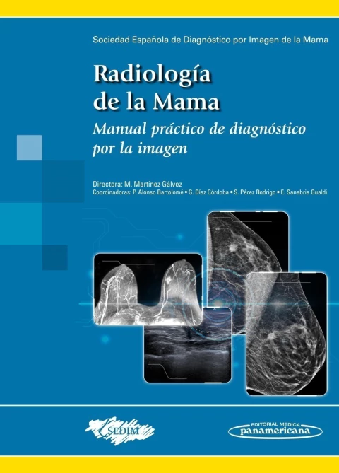 RADIOLOGÍA DE LA MAMA - MARÍA MARTÍNEZ GÁLVEZ