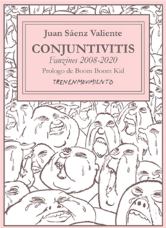 Tren en movimiento - Conjuntivitis