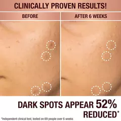 **PRE ORDEN** Charlotte Tilbury - Dark Spot Correcting Radiance Recovery Serum en internet