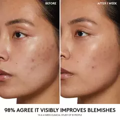 **PRE ORDEN** Fenty Beauty by Rihanna - Cherry Dub Pore Purify’r Gel Cleanser - Beauty Glam by Kar