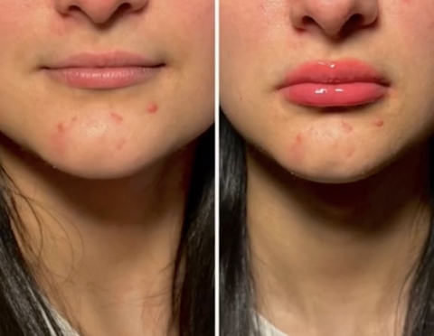 Gloss Pump Belle - Preenchimento Natural Coleção Nova! - Compre 2 e Ganhe 1 de BRINDE