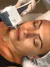 2 SESIONES DE CRIORADIOFRECUENCIA + 2 SESIONES DE RADIOFRECUENCIA FRACCIONADA FACIAL