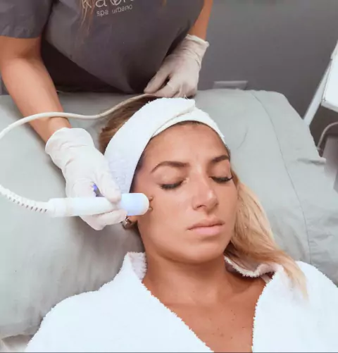 RADIOFRECUENCIA FACIAL