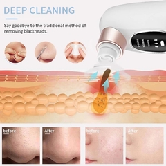 Limpiador Facial en internet