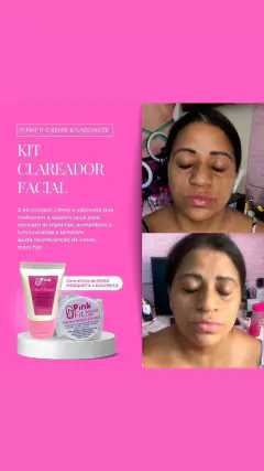 kit clareador na internet