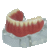Macro Modelo Mandíbula Overdenture Acrílica com 2 Barra Bola e Prótese Inferior