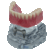 Macro Modelo Overdenture Mandíbula Acrílica Barra Clip + Prótese