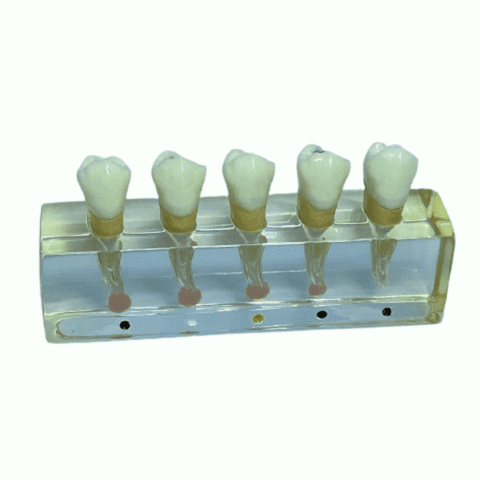Modelo de Endodontia com 4 Elementos