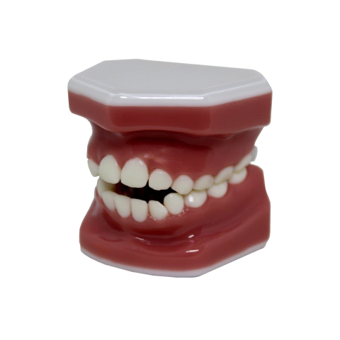 Macro Modelo Mordida Aberta Anterior Dentição Mista