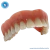 Macro Modelo Overdenture em Acrílico com 4 implantes Barra Clip - Macro Modelos Odontológicos