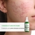 Cosmobeauty Fluído Secativo Acne Spec Concentrado 30ml - loja online