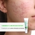 Cosmobeauty Acne Spec Secative Point Creme Concentrado 15g - loja online