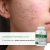 Cosmobeauty Nutrame A.C.N-IN Cápsulas para Acne 30 dias - loja online