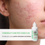 Cosmobeauty Acne Spec Acqua Fluid Secativo FPS 85 50ml - loja online
