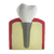 Maqueta Implante Dental
