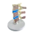 Maqueta Osteoporisis Vertebras Lumbares