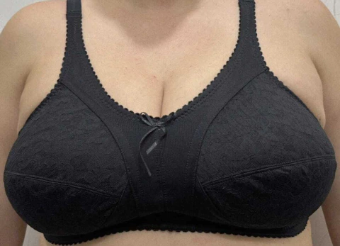 Corpiño Mastectomía Milanda con encaje Art.9