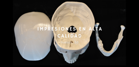 Huesos_3d
