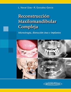 RECONSTRUCCION MAXILOMANDIBULAR COMPLEJA