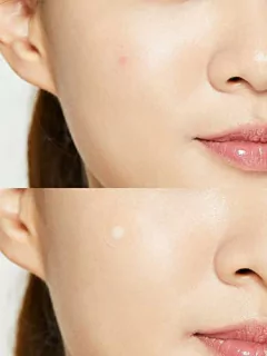 Parches para el acné - AC Clear Spot Patch - K-Beauty Shop