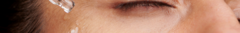 Banner da categoria Manchas e Melasma
