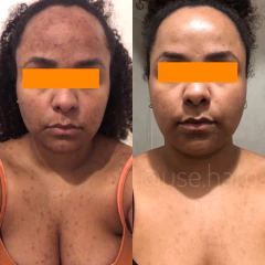 DUPLA TCHAU MANCHINHAS - CORPORAL E FACIAL - USE HARO COSMÉTICOS