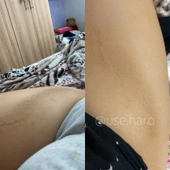 KIT CLAREADOR COMPLETO - CORPORAL E FACIAL - comprar online