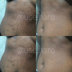 SABONETE CLAREADOR - FACIAL E CORPORAL - loja online